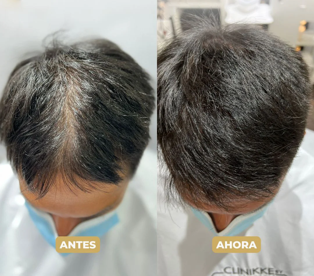 harmonyx-clinikke-50